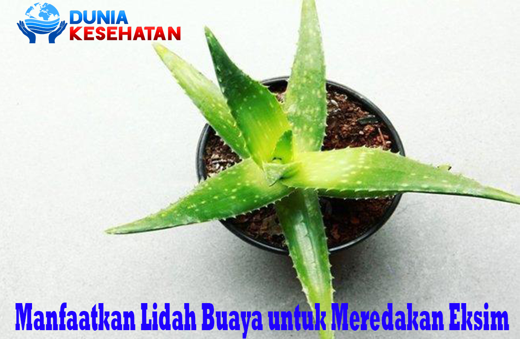 Manfaatkan Lidah Buaya untuk Meredakan Eksim