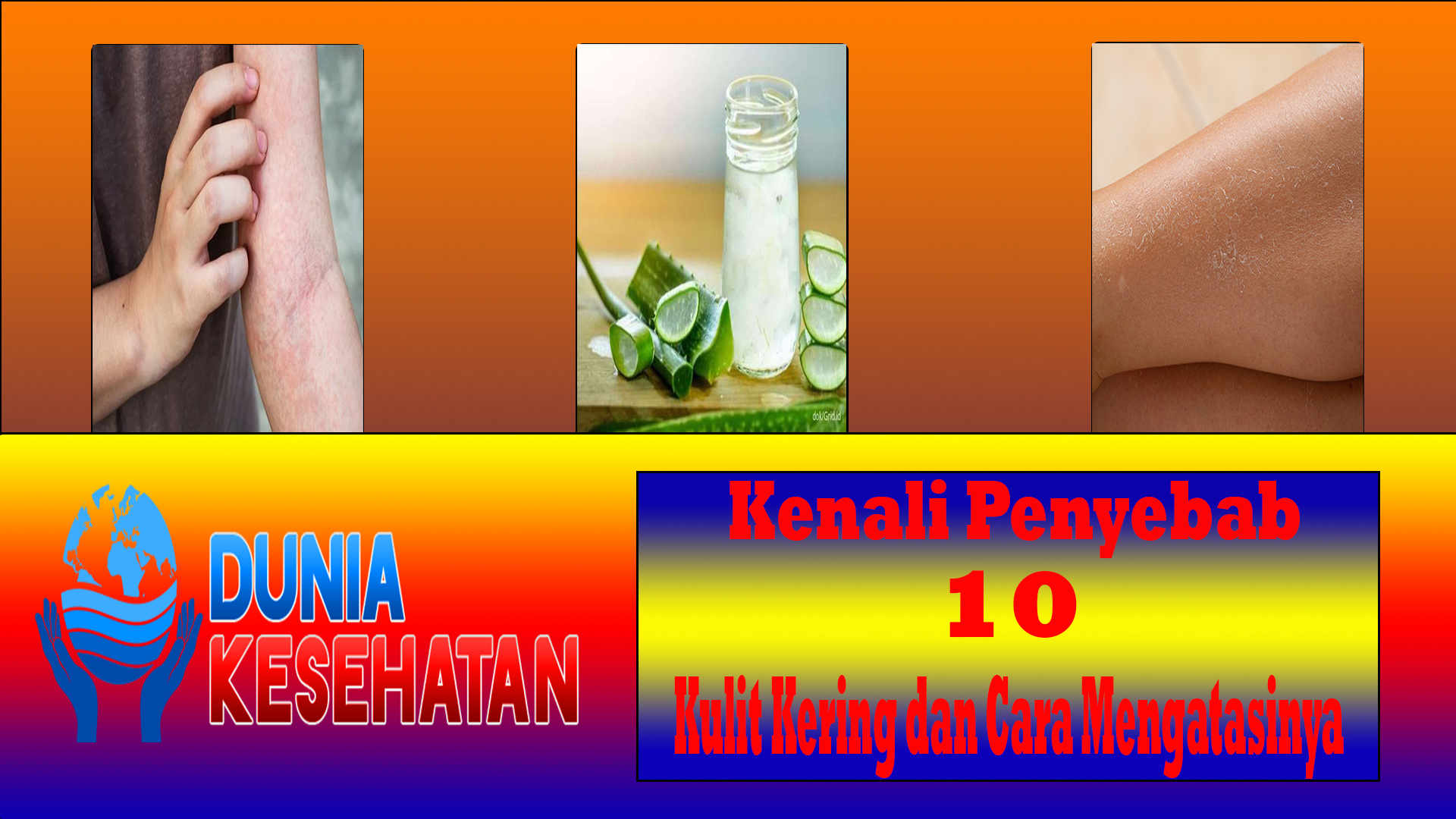 Kenali Penyebab 10 Kulit Kering dan Cara Mengatasinya