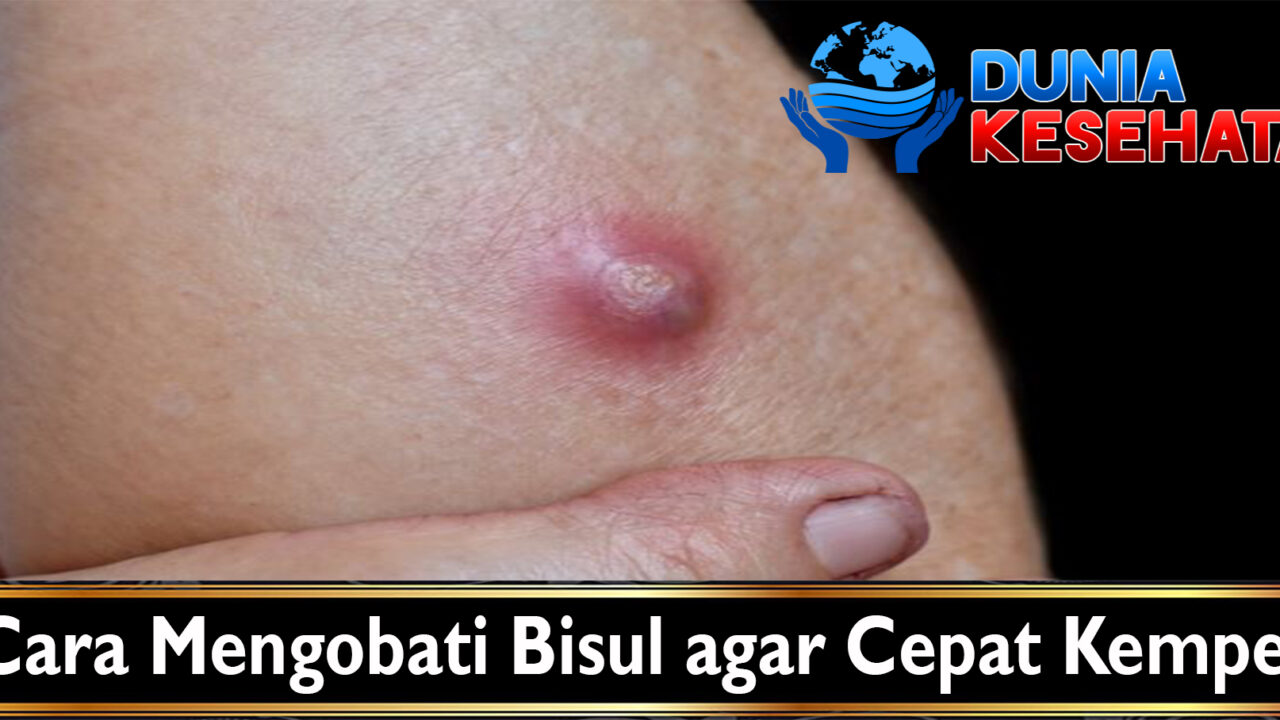Cara Mengobati Bisul agar Cepat Kempes