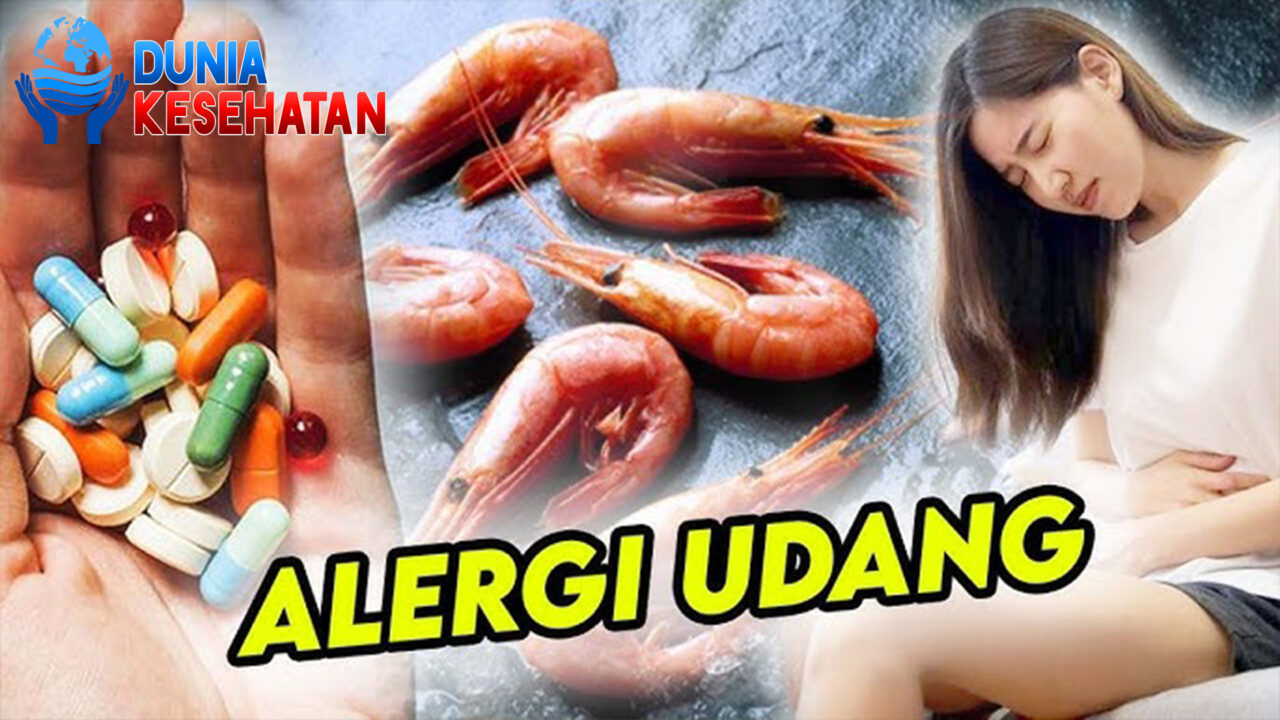 Obat Alergi Udang untuk Pertolongan Pertama Saat Kambuh