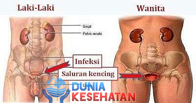 Anyang Anyangan: Gangguan Ringan yang Bisa Jadi Masalah Serius